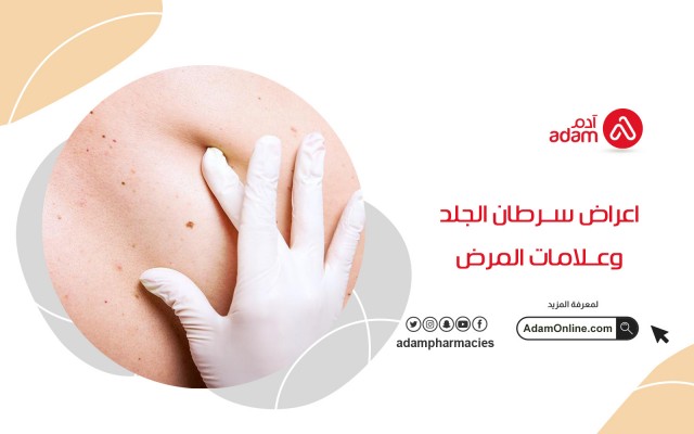 اعراض سرطان الجلد وعلامات المرض